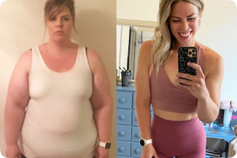 Voor en na – vrouwelijke klant